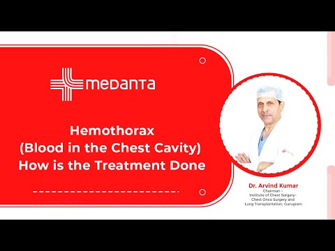  Hemothorax(Blood in the Chest Cavity): How is the Treatment Done? 